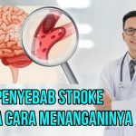 Cara Mengatasi Stroke Secara Alami Panduan Komprehensif Untuk Pemulihan Dan Pencegahan