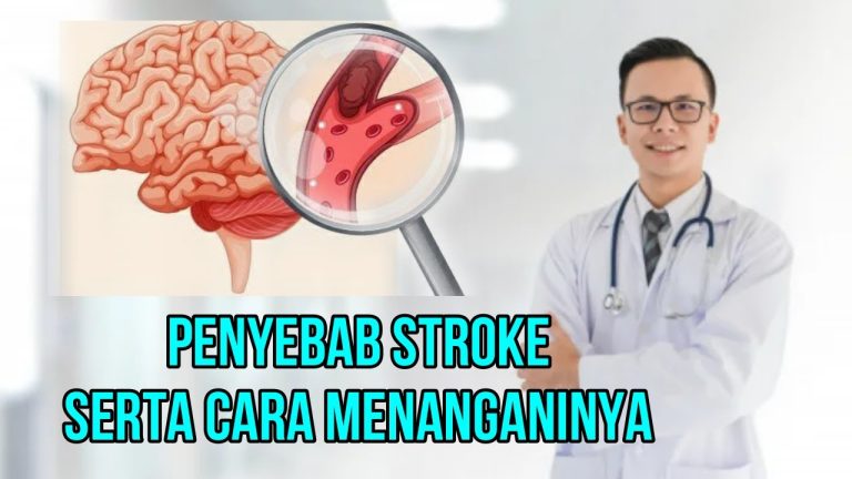 Cara Mengatasi Stroke Secara Alami Panduan Komprehensif Untuk Pemulihan Dan Pencegahan