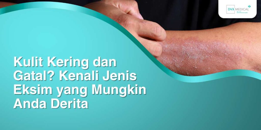 Kesalahan Umum Saat Menghadapi Eksim Panduan Komprehensif Untuk Perawatan Yang Efektif
