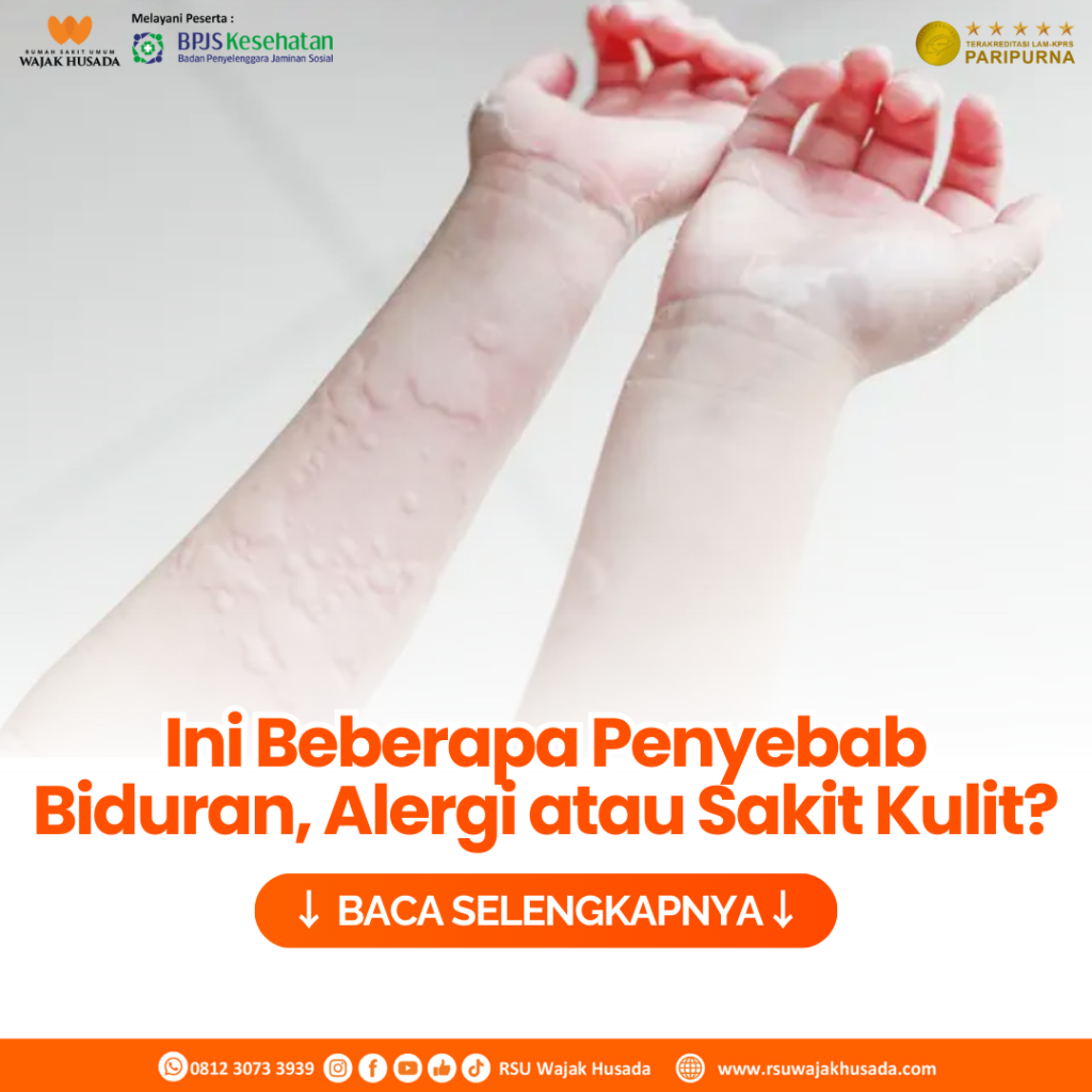 Mengungkap Kesalahan Umum Saat Menghadapi Alergi Kulit Panduan Lengkap Untuk Penanganan Yang Tepat