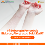 Mengungkap Kesalahan Umum Saat Menghadapi Alergi Kulit Panduan Lengkap Untuk Penanganan Yang Tepat